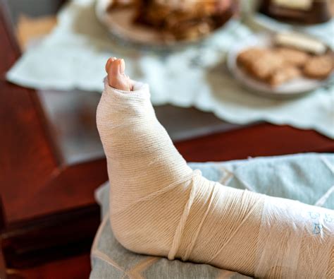 Metatarsal (Forefoot) Fracture - Ross Center For Orthopedics