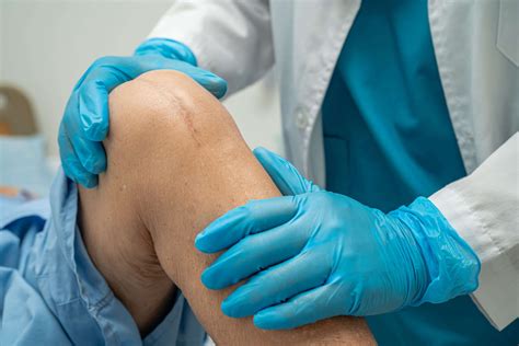 Soap For Surgical Wounds: A Guide To Proper Care And Healing