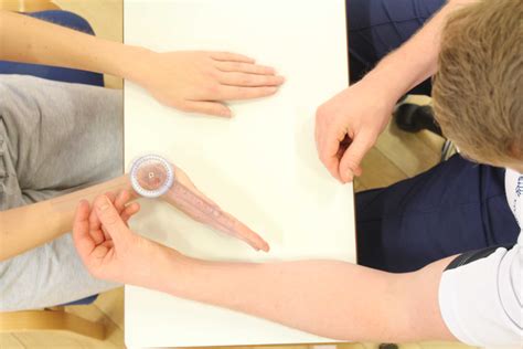 Sprained Wrist Treatment