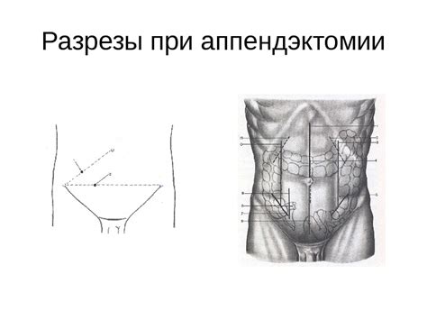 Топографическая анатомия и оперативная хирургия кишечника