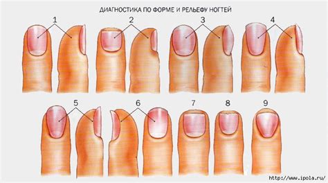О чём могут говорить изменения в ногтевых пластинах?. Обсуждение на ...