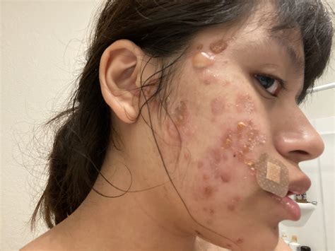 I don’t know what’s going on with my skin and it’s scaring me a little