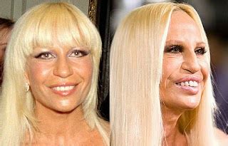 Has Donatella Versace had Plastic Surgery Gone Wrong Before and After ...