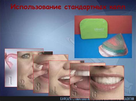 Местные средства профилактики кариеса - online presentation