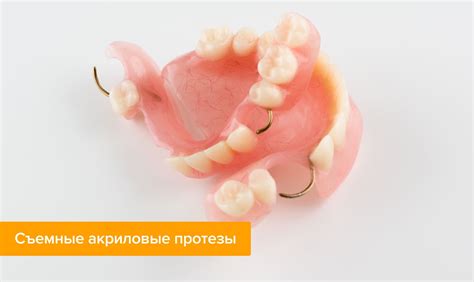 Акриловые зубные протезы: виды, фото, цена