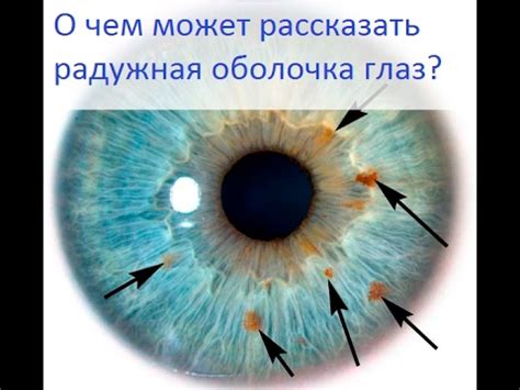 О чем может рассказать радужная оболочка глаз? - Все обо всем - YouTube