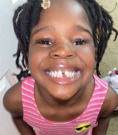 A Crianca Mais Feia Do Mundo - 4 anos após viralizar dizendo que era feia, menina fala sobre ...