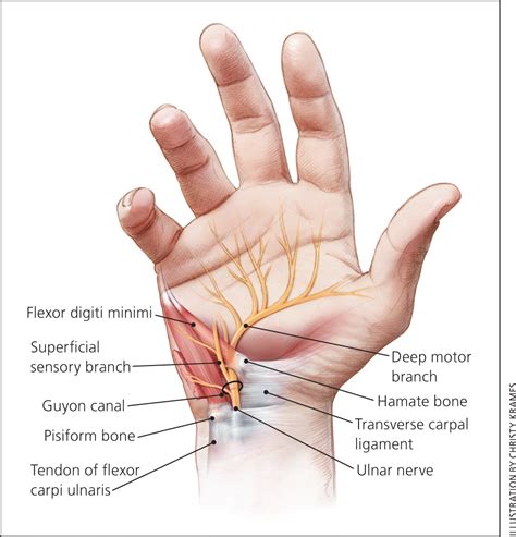 Evaluation and Diagnosis of Wrist Pain: A Case-Based Approach ...