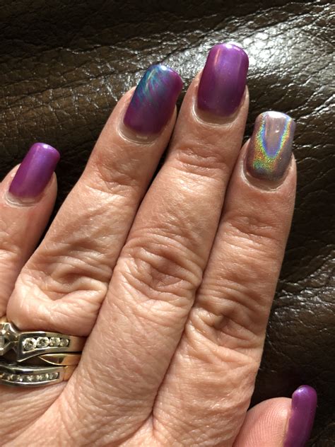 Nail Clubbing Cystic Fibrosis at Doris Watson blog