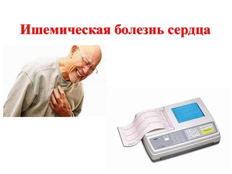 Ишемическая болезнь сердца - online presentation