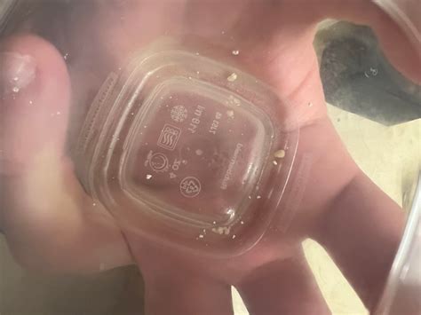 Foamy urine or bubbles? Same urine 10 seconds apart : r/KidneyStones
