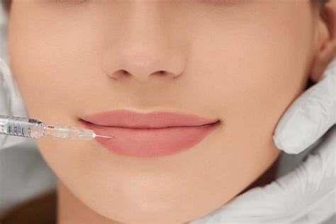 Филъри за Устни | Трайни и Видими Резултати | VDerm