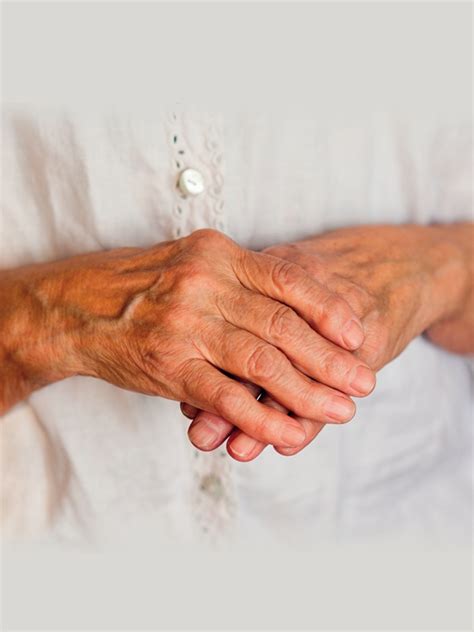 Psoriatic Arthritis Treatment | MIMS Indonesia