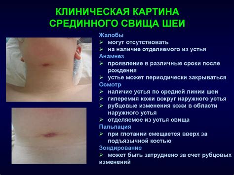 Врожденные синдромы. Врожденные кисты и свищи шеи. Дермоидные кисты ...