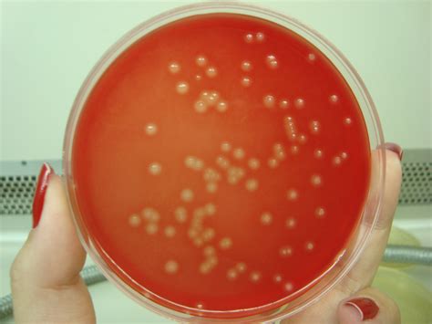 Streptococcus pneumoniae