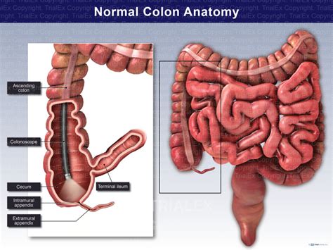 normal colon anatomy anterior cut  view trialexhibits