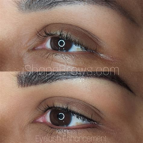 Permanent Eyeliner - iShape Beauty Clinic