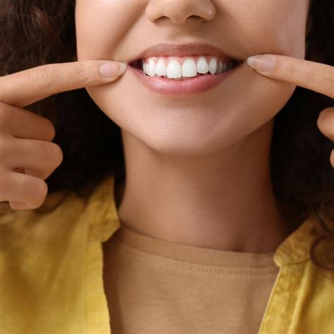 From Chips to Gaps: How Dental Veneers Can Fix Your Teeth Imperfections ...