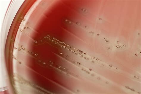 streptococcus pneumoniae bacteria culture  photograph  daniela