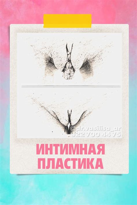 врач-гинеколог лобиопластика медицинские показания и противопоказания ...