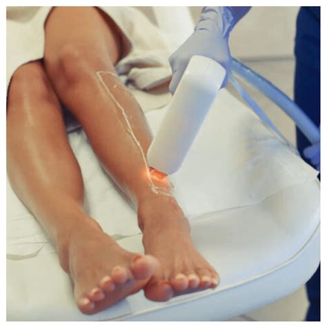 hair laser removal chicago 7