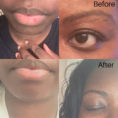 She Tried It! Sally Hansen Microwavable Eyebrow, Lip, Face Wax Kit