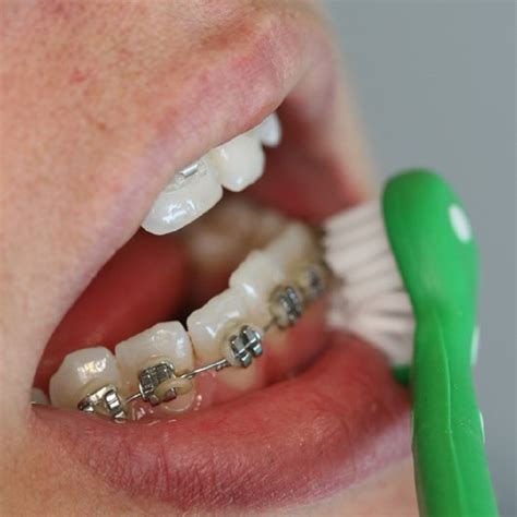 surround  sided toothbrush adult