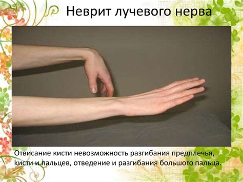 Нейропатии рук (локтевой, лучевой, срединный) - презентация онлайн