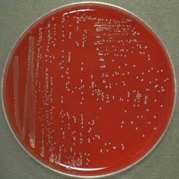 Streptococcus bovis - Alchetron, The Free Social Encyclopedia