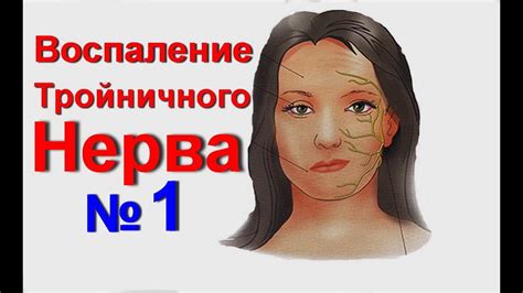 Воспаление тройничного нерва. Невралгия–тройничный нерв лечение ...