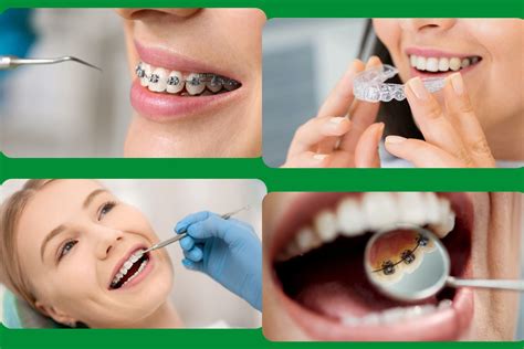 tipos de ortodoncia molina de segura molident