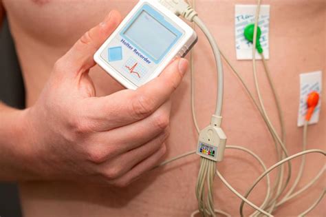 Ambulatory Cardiac Monitoring Devices Market Revenue to Cross