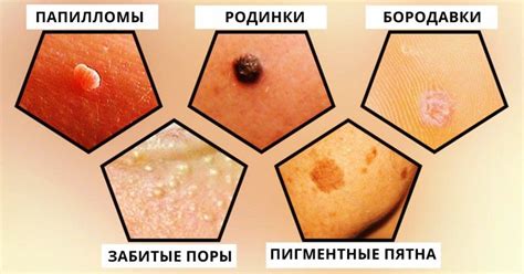 Пин на доске Здоровье