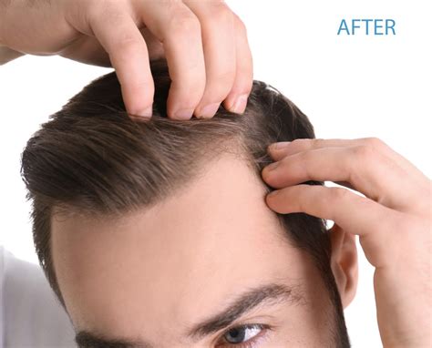 Hair Growth Treatment | Advanced PainCare and BioHealth Institute