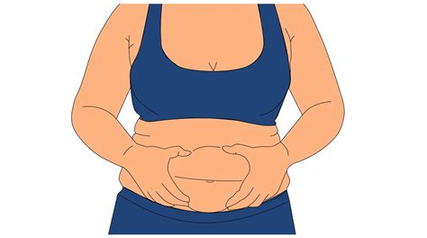 Día de la Obesidad: 6 de cada 10 argentinos están excedidos de peso y 1 ...