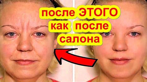РАЗГЛАДИТ ВСЕ МОРЩИНЫ Даже в 70 ЛЕТ! Сильнейшая Маска для Лица от ...