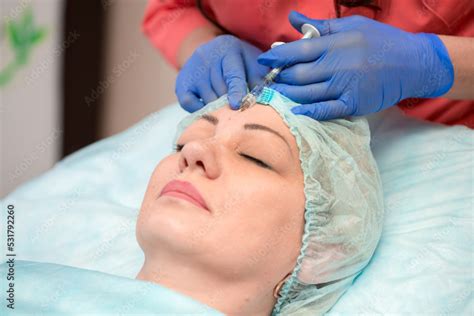 Injection facial rejuvenation. The cosmetologist injects cosmetic ...