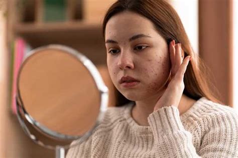 Эффективные методы лечения подкожного прыща: советы и рекомендации