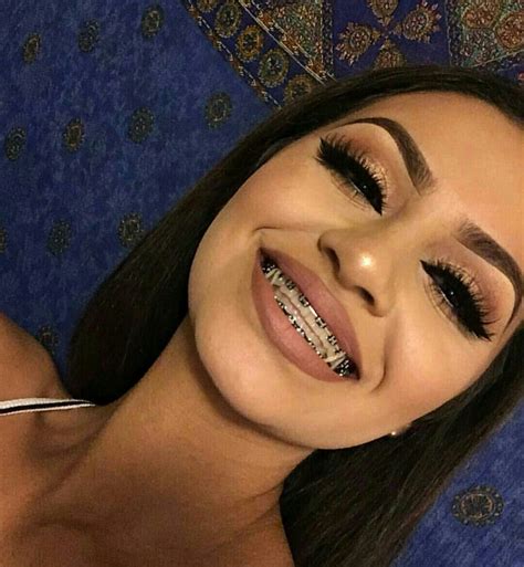 good braces colors  dark skin warehouse  ideas