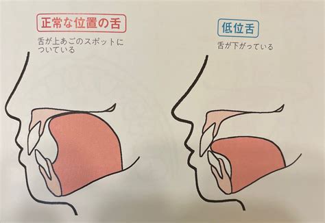 舌の位置、舌の動き大丈夫？！ | 医療法人さかの歯科｜京都市西京区の歯医者ならさかの歯科