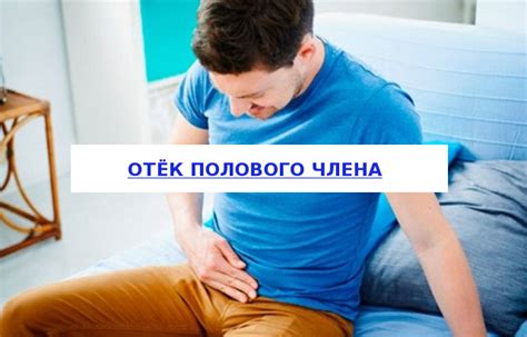 Опух член: причины, симптомы, диагностика, лечение, профилактика