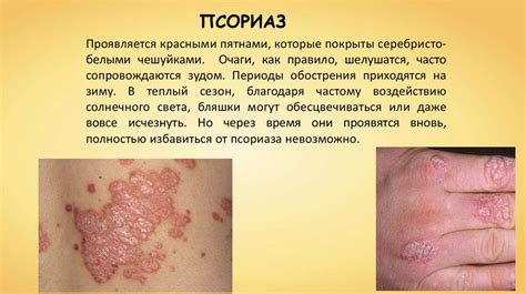 Болезни и травмы кожи - презентация онлайн