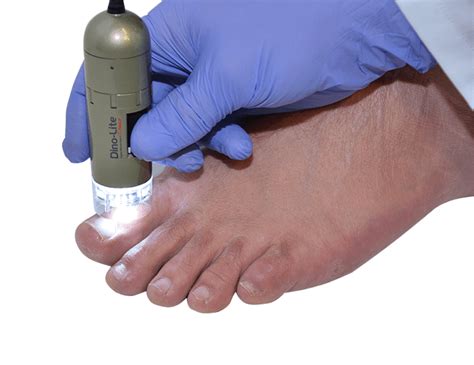 Medical