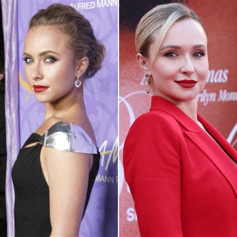 Did Hayden Panettiere Get Plastic Surgery? Then, Now Photos