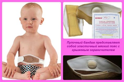 Комаровски - Пъпна херния при новородени: лечение, масаж