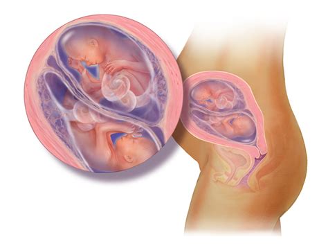 Como Gemeos Ficam Na Barriga
