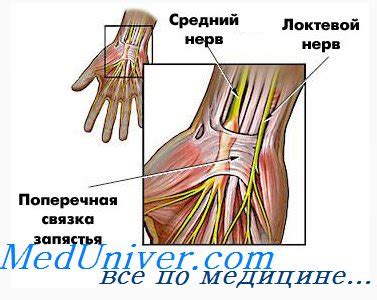Синдром запястного канала. Невропатия локтевого нерва.