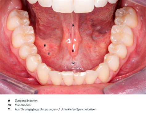 Gesunder Mund – Wie ist der Mund aufgebaut und welche Aufgaben hat er?