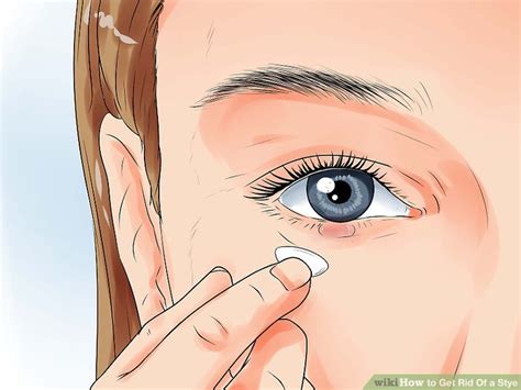 how to get rid of a stye immediately