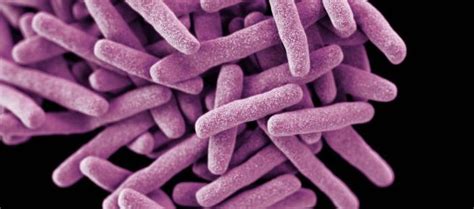 MYCOBACTERIUM INFECTION – Dermatology Conditions and Treatments